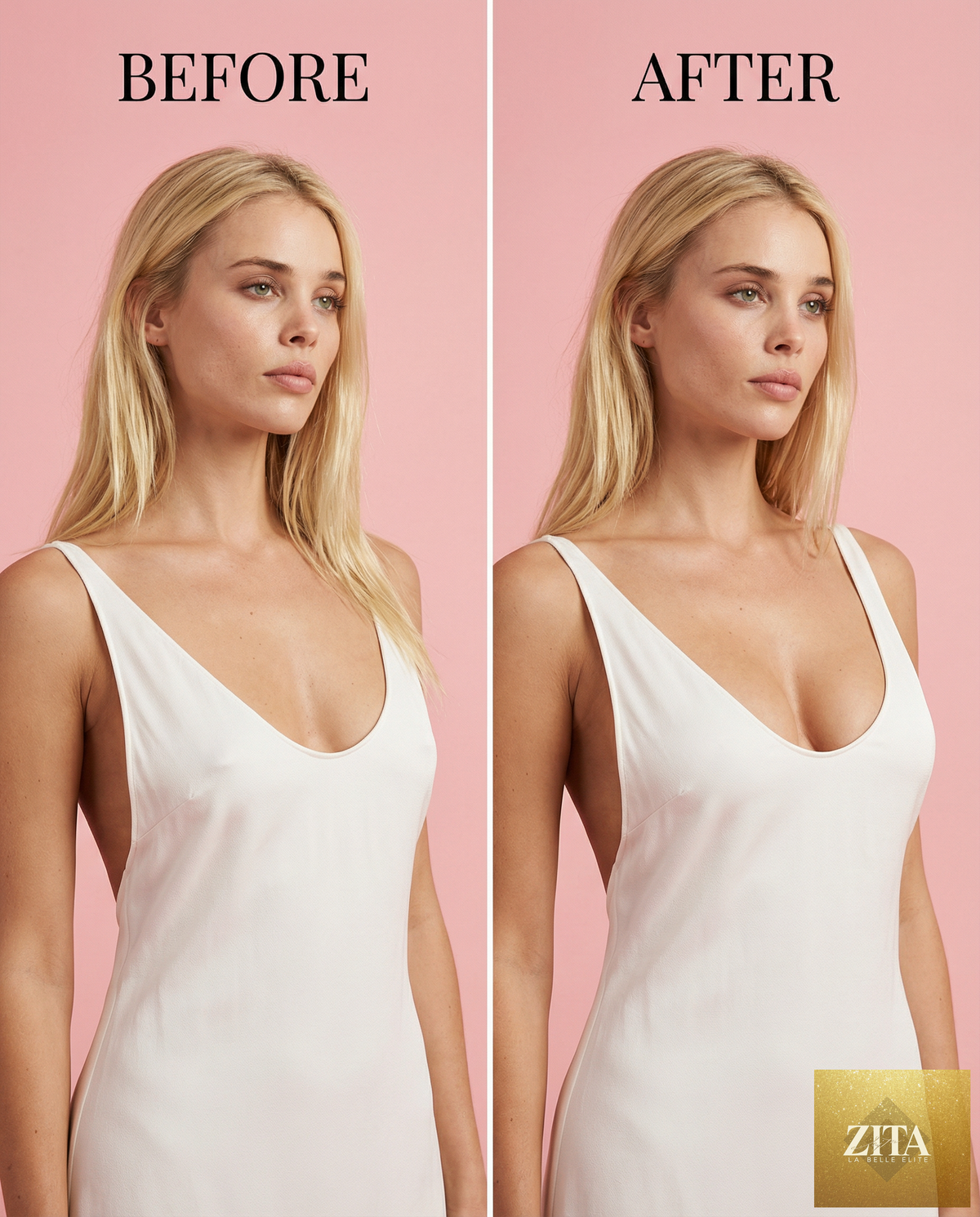 Sticky Boobs sticky bra worn under a backless white dress, showing how it provides invisible support and enhances cleavage.